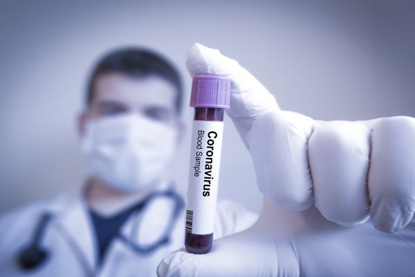 coronavirus-(covid-19)-:-retour-de-l’etat-d’urgence-sanitaire-et-mise-en-place-d’un-couvre-feu-!