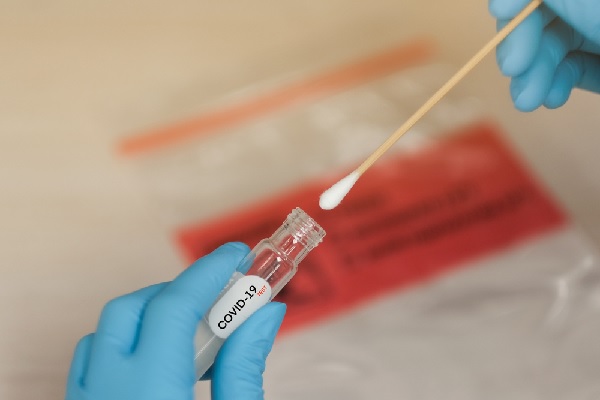 coronavirus-(covid-19)-et-variants-bresilien-et-sud-africain-:-de-nouvelles-mesures-de-sante