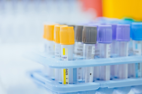 professionnels-de-sante-:-du-nouveau-pour-les-examens-biologiques